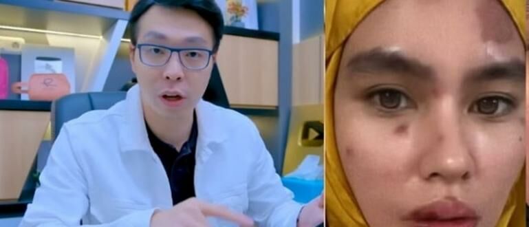 Komentari Kondisi Wajah Kartika Putri Dokter Richard Lee Malah