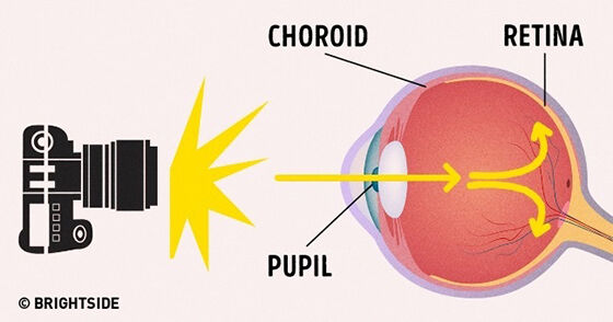 Ini Dia Alasannya Kenapa Terjadi Efek Mata Merah Saat Difoto | JalanTikus