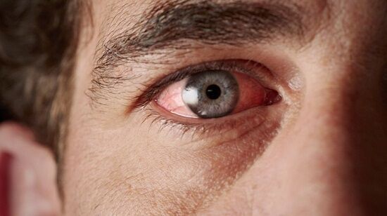 Keseringan bermain game bisa merusak mata