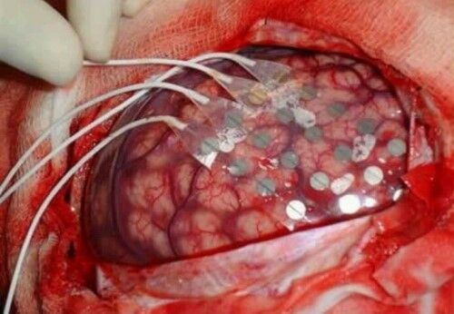 foto-biohorizon-operasiteknologi5