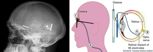 foto-extremetech-operasiteknologi2