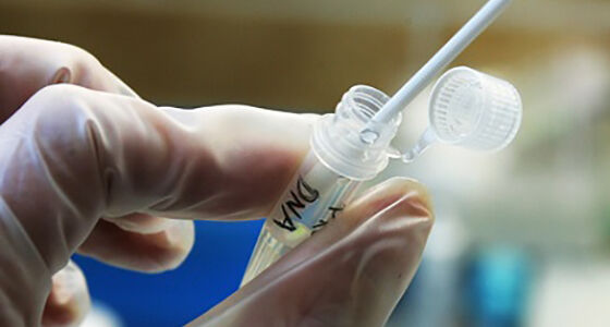 Proses Analisa DNA Cepat