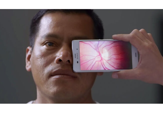 Bahaya Gunakan Smartphone Layar Pecah 4