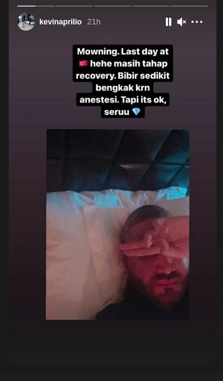 Kevin Aprilio Transplantasi Rambut 4 6fa55