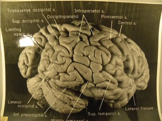 Otak Albert Einstein Dicuri 74fe4