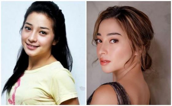 Kpop Yang Operasi Plastik B077c