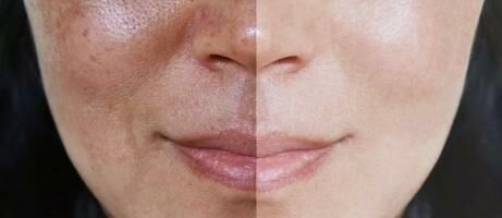 7+ Cara Merawat Wajah Agar Tidak Kusam, Langsung Sehat dan Bercahaya!