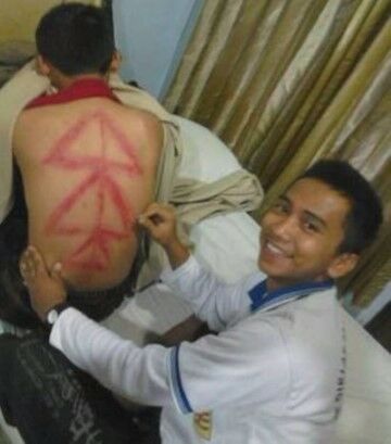 5 Potret Kocak Motif Kerokan F47e9