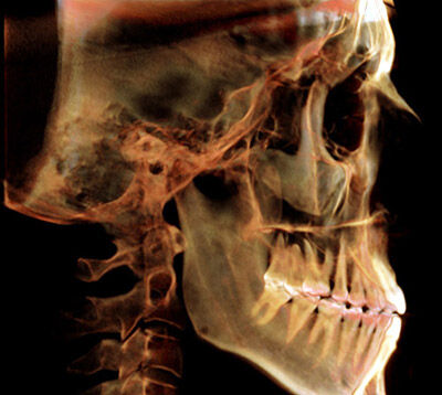 Mri Scan 1