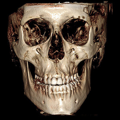 Mri Scan 3