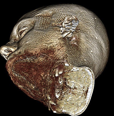 Mri Scan 9
