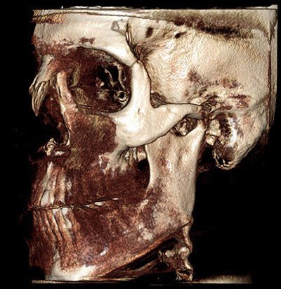 Mri Scan 5