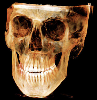 Mri Scan 2