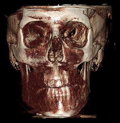 Mri Scan 8