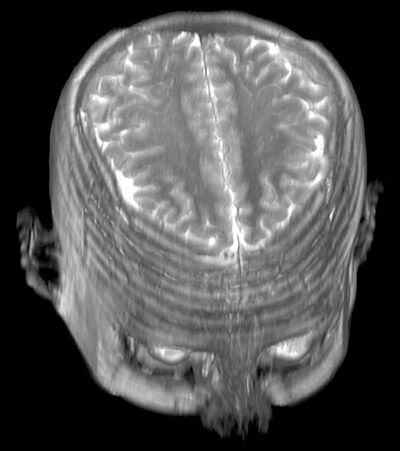 Mri Scan 4