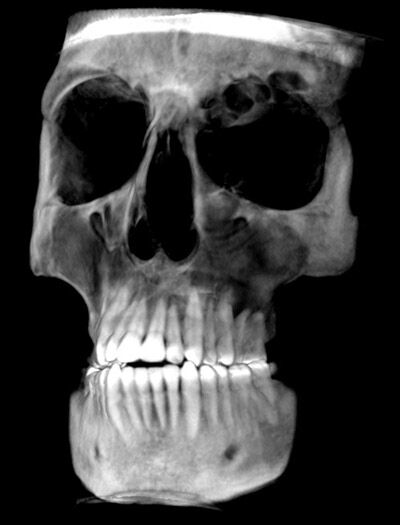 Mri Scan 7