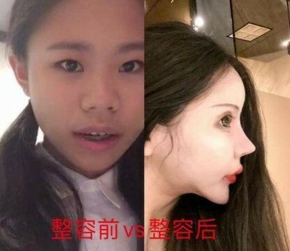 Xiao Z Na Na Before After 1fc73