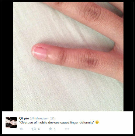 Sindrom Smartphone Pinky 2