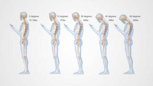 Smartphone Merusak Leher1