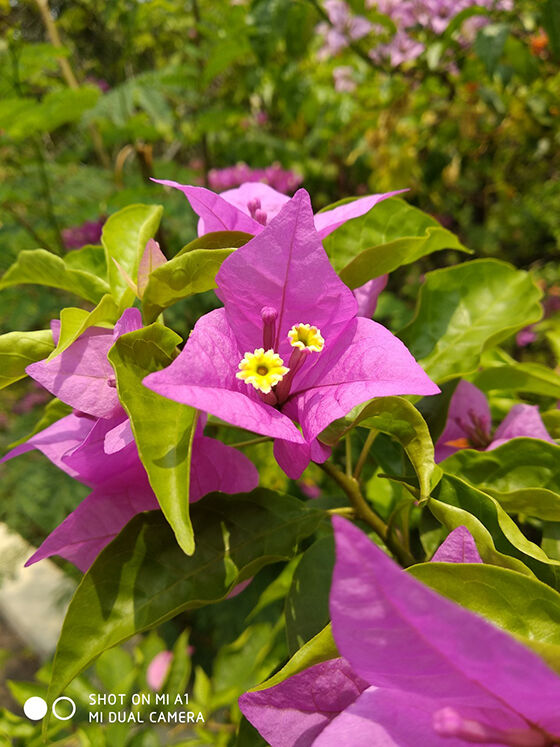 Hasil Foto Xiaomi Mi A1 05