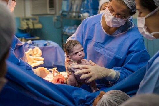 Bayi Lahir Dengan Ekspresi Marah 5d389