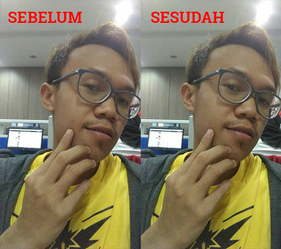 Cara Menghilangkan Jerawat 5