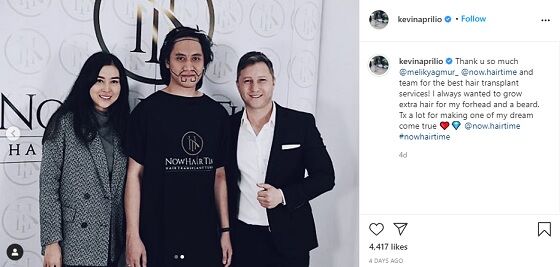 Kevin Aprilio Transplantasi Rambut 1 3f952