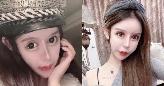 Gadis Tiongkok Operasi Wajah 60 Kali E6c22