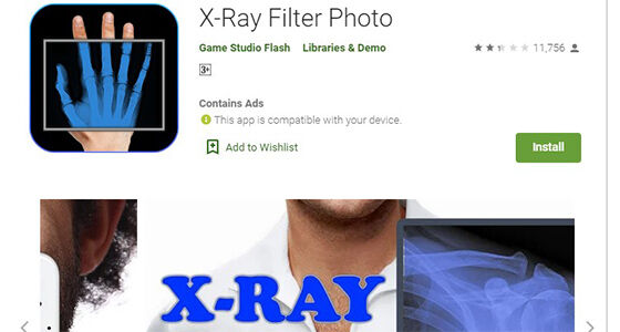 X Ray Filter Photo 1ea0e