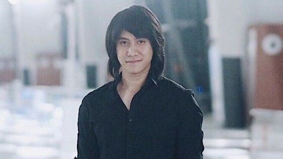 Artis Yang Mengalami Kebotakan 731bd