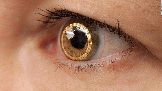Google X Lense Penemuan Teknologi Mengubah Dunia