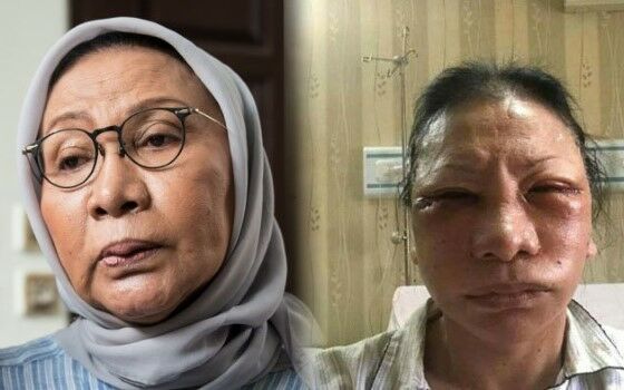 Hoaks Terjadi 2018 2 E6766