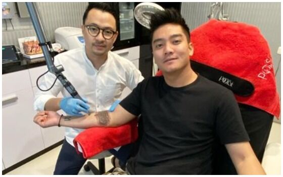 Artis Indonesia Yang Menghapus Tato Di Tubuhnya Boy William 01199