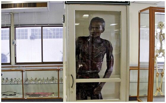 Museum Teraneh Di Dunia Museum Siriraj C34d5