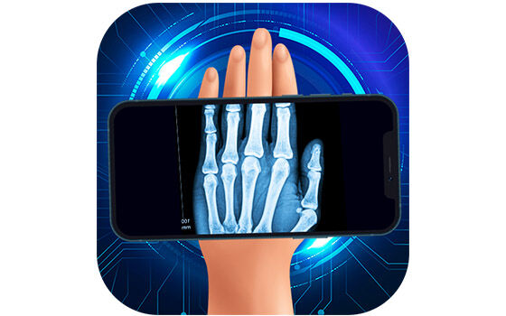 Xray Scanner Prank D529c