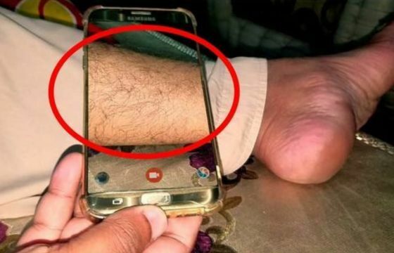X Ray Full Body Prank 6ce7a