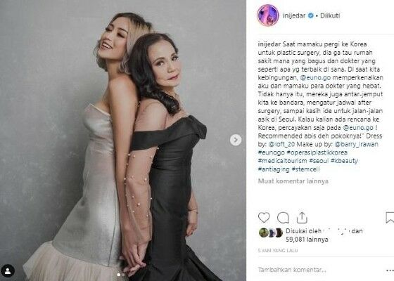 Jessica Iskandar Hadiahi Ibunda Operasi Facelift 69bd5