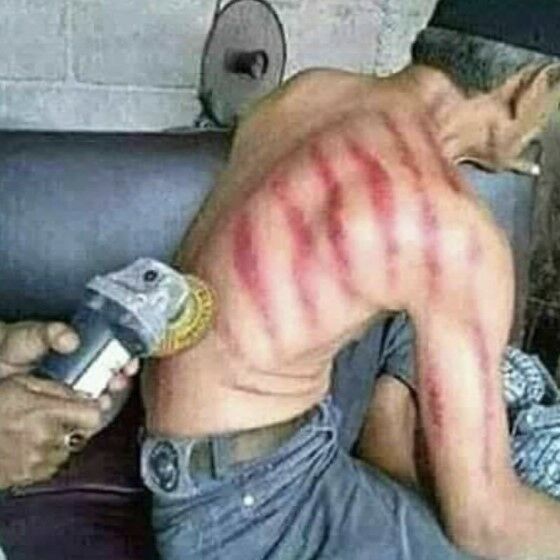 10 Potret Kocak Motif Kerokan De18e