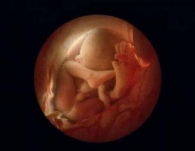 Foto Bagaimana Bayi Lahir 23