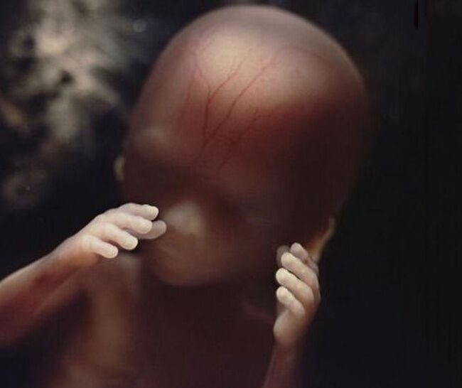 Foto Bagaimana Bayi Lahir 16