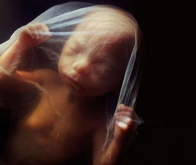 Foto Bagaimana Bayi Lahir 18