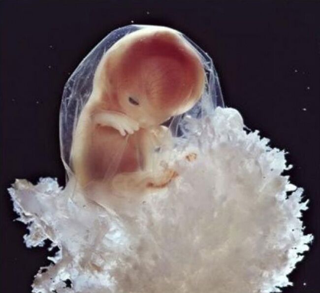 Foto Bagaimana Bayi Lahir 15