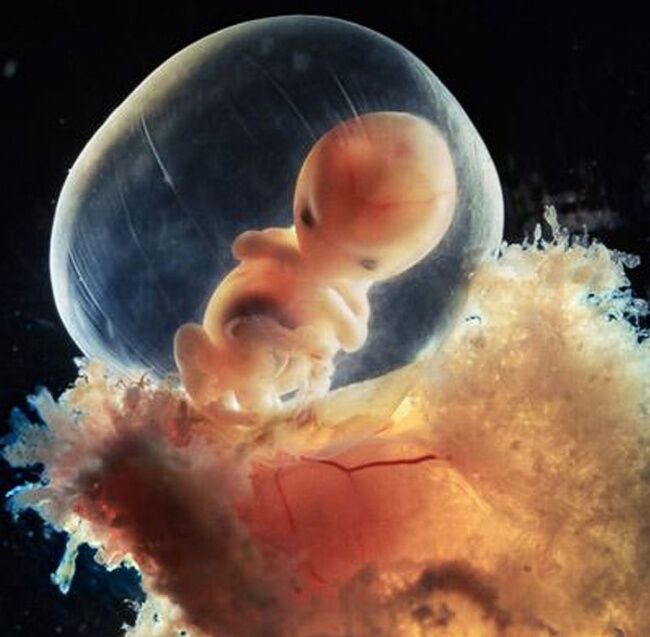 Foto Bagaimana Bayi Lahir 13