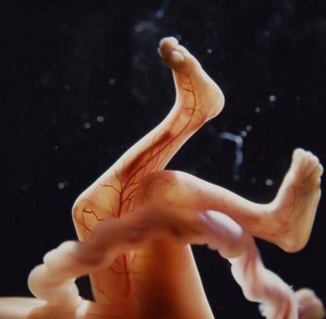 Foto Bagaimana Bayi Lahir 17
