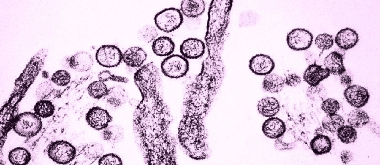 Hantavirus 2db7e