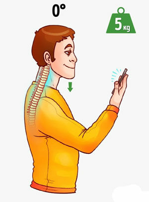 Bungkuk Karena Smartphone 2