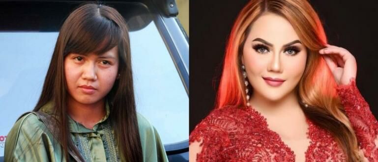 Potret Transformasi Pedangdut Nita Thalia dari Awal Karier Hingga
