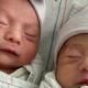 Bayi Kembar Ini Lahir Beda Setahun Bagaimana Bisa Ed4d8
